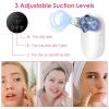 Blackhead Vacuum Remover Acne Remover Electric Blackhead Comedone Extractor Tool Facial Pore Cleaner Pimple Suction Tool